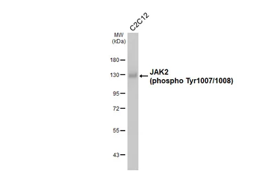 Anti-JAK2 (phospho Tyr1007/1008) antibody used in Western Blot (WB). GTX132784