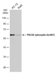 Anti-PDCD4 (phospho Ser457) antibody used in Western Blot (WB). GTX132798