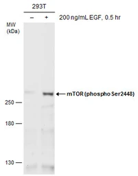 Anti-mTOR (phospho Ser2448) antibody used in Western Blot (WB). GTX132803