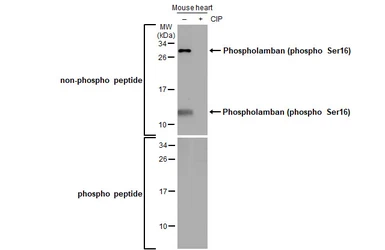 Anti-Phospholamban (phospho Ser16) antibody used in Western Blot (WB). GTX132818