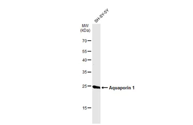 Anti-Aquaporin 1 antibody used in Western Blot (WB). GTX132870