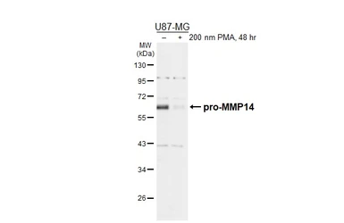 Anti-MMP14 antibody used in Western Blot (WB). GTX132884