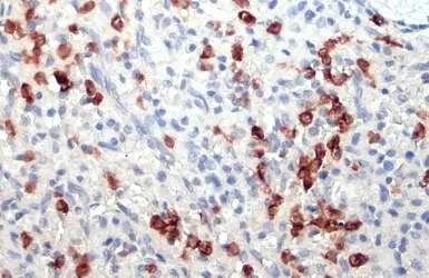 Anti-Lipocalin-2 antibody used in IHC (Paraffin sections) (IHC-P). GTX132906