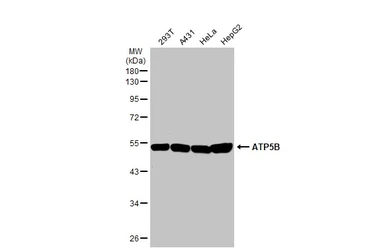 Anti-ATP5B antibody used in Western Blot (WB). GTX132925