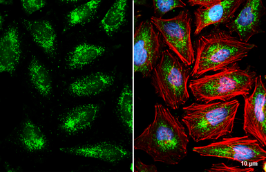 Anti-PMP70 antibody used in Immunocytochemistry/ Immunofluorescence (ICC/IF). GTX132932