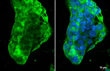 Anti-ABCA1 antibody used in Immunocytochemistry/ Immunofluorescence (ICC/IF). GTX132946