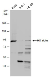 Anti-IKK alpha antibody used in Western Blot (WB). GTX132964