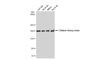 Anti-Clathrin Heavy chain antibody used in Western Blot (WB). GTX132976