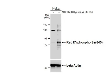 Anti-Rad17 (phospho Ser645) antibody used in Western Blot (WB). GTX133005
