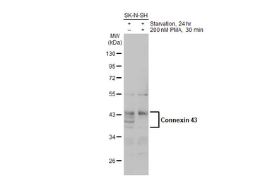 Anti-Connexin 43 antibody used in Western Blot (WB). GTX133022