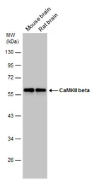 Anti-CaMKII beta antibody used in Western Blot (WB). GTX133072