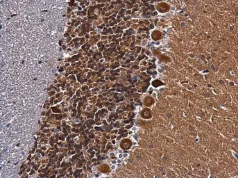 Anti-CaMKII beta antibody used in IHC (Paraffin sections) (IHC-P). GTX133072