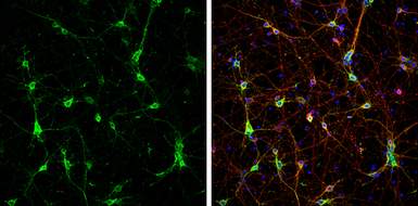 Anti-CaMKII beta antibody used in Immunocytochemistry/ Immunofluorescence (ICC/IF). GTX133072