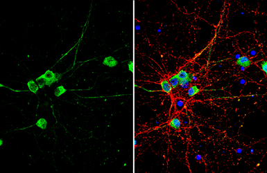 Anti-NMDAR1 antibody used in Immunocytochemistry/ Immunofluorescence (ICC/IF). GTX133097