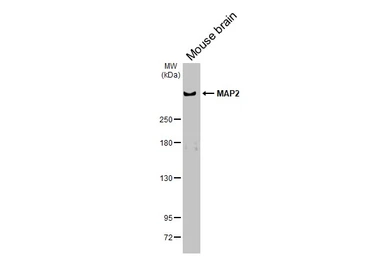 Anti-MAP2 antibody used in Western Blot (WB). GTX133109