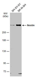 Anti-Nestin antibody used in Western Blot (WB). GTX133111