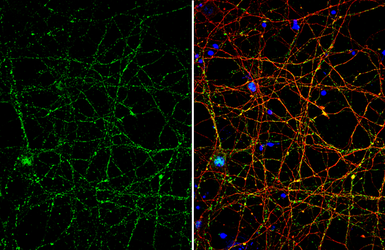 Anti-VGluT1 antibody used in Immunocytochemistry/ Immunofluorescence (ICC/IF). GTX133148