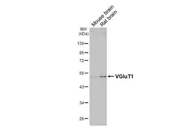 Anti-VGluT1 antibody used in Western Blot (WB). GTX133148
