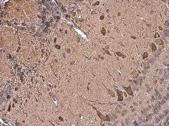 Anti-Dopamine Transporter antibody used in IHC (Paraffin sections) (IHC-P). GTX133152