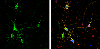 Anti-Dopamine Transporter antibody used in Immunocytochemistry/ Immunofluorescence (ICC/IF). GTX133152