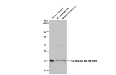 Anti-Dopamine Transporter antibody used in Western Blot (WB). GTX133152