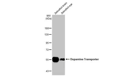 Anti-Dopamine Transporter antibody used in Western Blot (WB). GTX133152