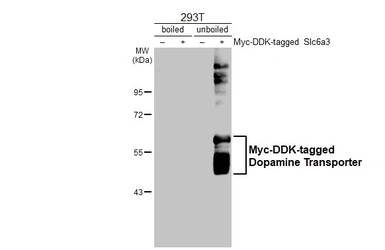 Anti-Dopamine Transporter antibody used in Western Blot (WB). GTX133152