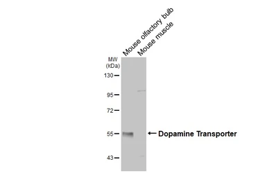Anti-Dopamine Transporter antibody used in Western Blot (WB). GTX133152