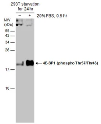 Anti-4E-BP1 (phospho Thr37/Thr46) antibody used in Western Blot (WB). GTX133181