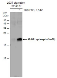 Anti-4E-BP1 (phospho Ser65) antibody used in Western Blot (WB). GTX133184