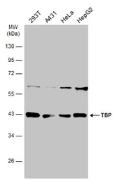 Anti-TBP antibody used in Western Blot (WB). GTX133204