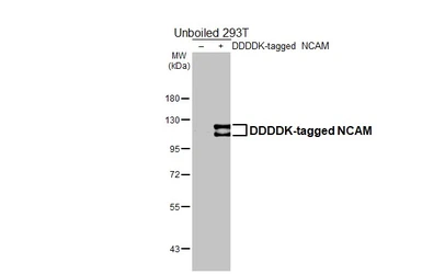Anti-NCAM antibody used in Western Blot (WB). GTX133217
