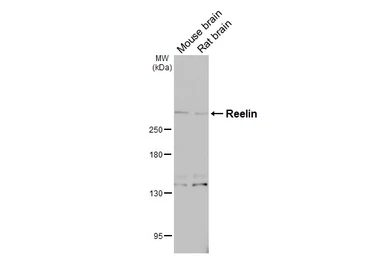 Anti-Reelin antibody used in Western Blot (WB). GTX133226