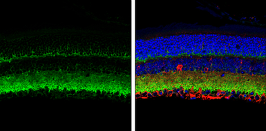 Anti-VAMP2 antibody used in IHC (Paraffin sections) (IHC-P). GTX133241