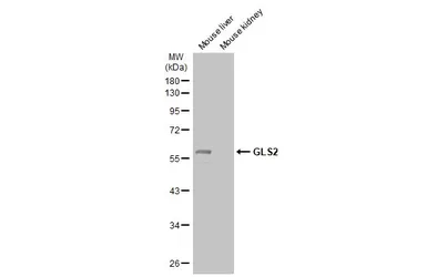 Anti-GLS2 antibody used in Western Blot (WB). GTX133243