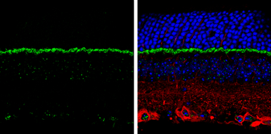 Anti-PSD95 antibody used in IHC (Paraffin sections) (IHC-P). GTX133255