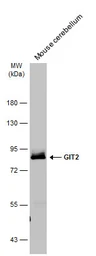 Anti-GIT2 antibody used in Western Blot (WB). GTX133285