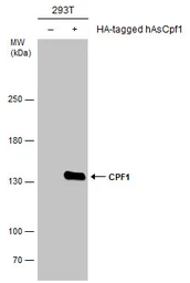 Anti-CPF1 antibody used in Western Blot (WB). GTX133296