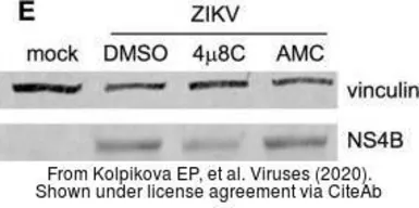 Anti-Zika virus NS4B protein antibody used in Western Blot (WB). GTX133311