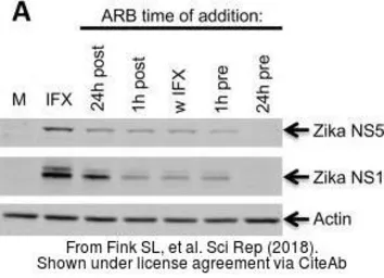 Anti-Zika virus NS5 protein antibody used in Western Blot (WB). GTX133312