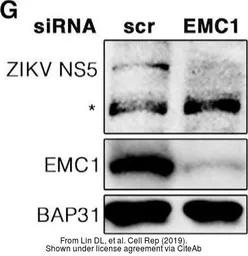 Anti-Zika virus NS5 protein antibody used in Western Blot (WB). GTX133312