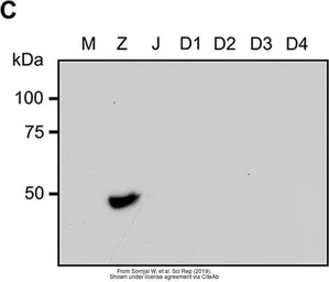 Anti-Zika virus Envelope protein antibody used in Western Blot (WB). GTX133326