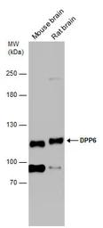 Anti-DPP6 antibody used in Western Blot (WB). GTX133338