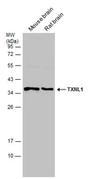 Anti-TXNL1 antibody used in Western Blot (WB). GTX133341