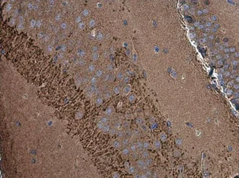 Anti-SH3GL1 antibody used in IHC (Paraffin sections) (IHC-P). GTX133349