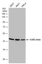 Anti-GSK3 beta antibody used in Western Blot (WB). GTX133372