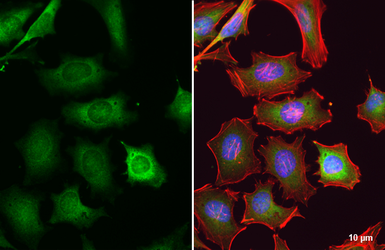 Anti-GSK3 beta antibody used in Immunocytochemistry/ Immunofluorescence (ICC/IF). GTX133372