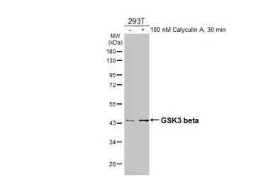 Anti-GSK3 beta antibody used in Western Blot (WB). GTX133372