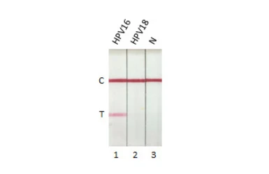 Human Papillomavirus type 16 E7 protein, His tag. GTX133411-pro