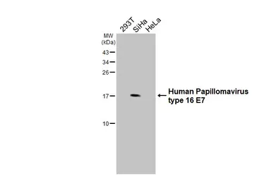 Anti-Human Papillomavirus type 16 E7 antibody used in Western Blot (WB). GTX133411
